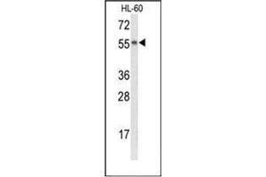 Western blot analysis of Nyctalopin Antibody (N-term) in HL-60 cell line lysates (35ug/lane). (Nyctalopin 抗体  (N-Term))