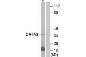 Western blot analysis of extracts from Jurkat cells, using OR6A2 Antibody. (OR6A2 抗体  (AA 58-107))