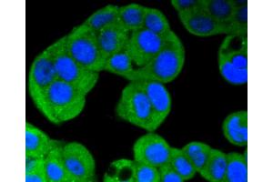 MCF-7 cells were stained with ERK5 (8D8) Monoclonal Antibody  at [1:200] incubated overnight at 4C, followed by secondary antibody incubation, DAPI staining of the nuclei and detection. (MAPK7 抗体)