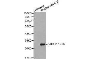 Western blot analysis of extracts from Hela cells using Phospho-BCL2L1-S62 antibody. (BCL2L1 抗体  (pSer62))
