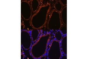 Immunofluorescence (IF) image for anti-Wingless-Type MMTV Integration Site Family, Member 5A (WNT5A) (AA 250-350) antibody (ABIN6150248)
