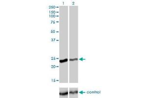 Western blot analysis of RAB4A over-expressed 293 cell line, cotransfected with RAB4A Validated Chimera RNAi (Lane 2) or non-transfected control (Lane 1). (Rab4 抗体  (AA 1-218))