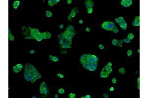 Immunofluorescent staining of HepG2 cells using anti-SORD mouse monoclonal antibody (ABIN2453678). (SORD 抗体)