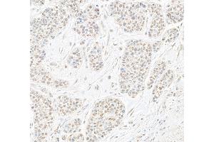 Immunohistochemistry (IHC) image for anti-V-Myb Myeloblastosis Viral Oncogene Homolog (Avian)-Like 2 (MYBL2) (AA 250-300) antibody (ABIN7454416)