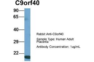 Host: Rabbit  Target Name: C9orf40  Sample Tissue: Human Adult Placenta  Antibody Dilution: 1. (C9orf40 抗体  (Middle Region))