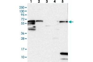 Western blot analysis of Lane 1: RT-4, Lane 2: U-251 MG, Lane 3: Human Plasma, Lane 4: Liver, Lane 5: Tonsil with ME3 polyclonal antibody . (ME3 抗体)