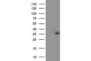 Western Blotting (WB) image for anti-Nudix (Nucleoside Diphosphate Linked Moiety X)-Type Motif 6 (NUDT6) antibody (ABIN1499871) (NUDT6 抗体)