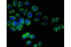 Immunofluorescent analysis of A549 cells using ABIN7173087 at dilution of 1:100 and Alexa Fluor 488-congugated AffiniPure Goat Anti-Rabbit IgG(H+L) (TMEM161B 抗体  (AA 1-487))