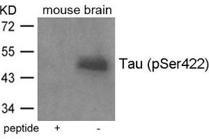 Western blot analysis of extracts from mouse brain tissue using Tau(Phospho-Ser422) Antibody and the same antibody preincubated with blocking peptide. (MAPT 抗体  (pSer422))