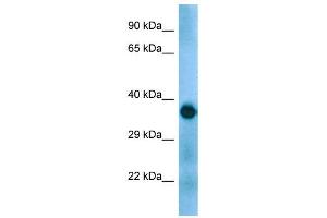 Host:  Rabbit  Target Name:  Gapdh  Sample Type:  Mouse Muscle lysates  Antibody Dilution:  1. (GAPDH 抗体  (C-Term))