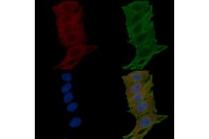ABIN6265360 and ABIN6276804 staining Hela cells(24h of starvation treatment) by IF/ICC. (Substance P 抗体  (N-Term))