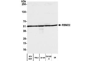 Western Blotting (WB) image for anti-RNA Binding Motif Protein 22 (RBM22) (AA 175-225) antibody (ABIN7449905)