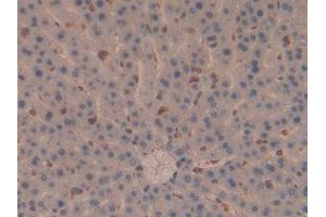 Immunohistochemistry (IHC) image for anti-Moesin (MSN) (AA 353-577) antibody (ABIN1859887)