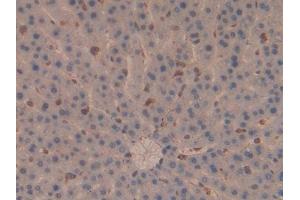 DAB staining on IHC-P; Samples: Rat Liver Tissue (Moesin 抗体  (AA 353-577))