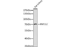 Western blot analysis of extracts of Rat kidney, using RNF112 antibody (ABIN7270054) at 1:1000 dilution. (RNF112 抗体  (AA 200-500))