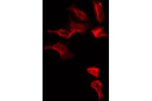 ABIN6274813 staining HepG2 by IF/ICC. (SLC25A6 抗体  (Internal Region))