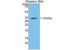 Western Blotting (WB) image for anti-Low Density Lipoprotein Receptor (LDLR) (AA 497-742) antibody (ABIN1868939) (LDLR 抗体  (AA 497-742))