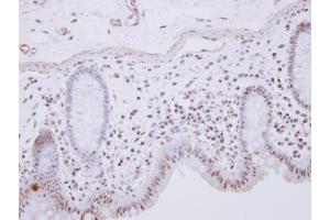 IHC-P Image RCL1 antibody [N1C3] detects RCL1 protein at nucleus on human normal colon by immunohistochemical analysis.