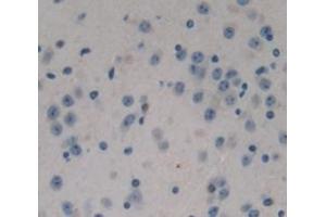 IHC-P analysis of Mouse Tissue, with DAB staining. (NPEPPS 抗体  (AA 584-755))