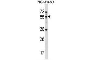 MEX3B Antibody (N-term) western blot analysis in NCI-H460 cell line lysates (35µg/lane). (MEX3B 抗体  (N-Term))