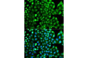Immunofluorescence analysis of A549 cells using HLA-DRB1 antibody. (HLA-DRB1 抗体)