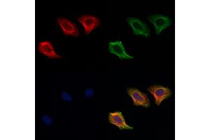 ABIN6256906 and ABIN6274857 staining Hela cells by IF/ICC. (Apolipoprotein L 2 抗体  (C-Term))