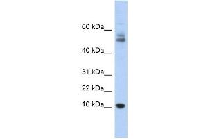 Myotrophin antibody used at 1 ug/ml to detect target protein. (MTPN 抗体  (Middle Region))