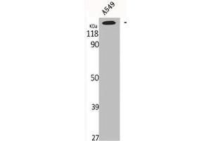 Western Blot analysis of A549 cells using GTBP Polyclonal Antibody (MSH6 抗体  (Internal Region))