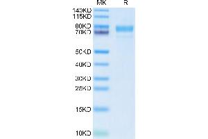 Cynomolgus Siglec-10 on Tris-Bis PAGE under reduced condition. (SIGLEC10 Protein (AA 17-552) (His tag))