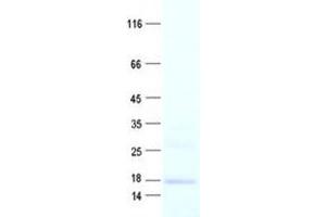 Validation with Western Blot (MMGT1 Protein (His tag))