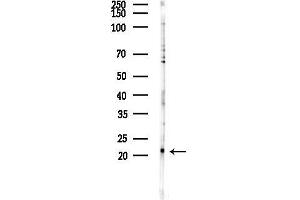 anti-RAP1B, Member of RAS Oncogene Family (RAP1B) (C-Term) antibody