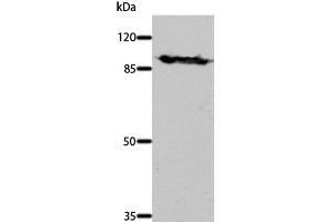 Western Blot analysis of Mouse brain tissue using DNM1 Polyclonal Antibody at dilution of 1:700 (Dynamin 1 抗体)