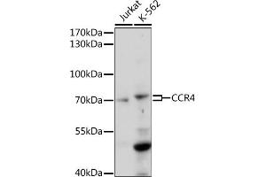 Western blot analysis of extracts of various cell lines, using CCR4 antibody (ABIN7266306) at 1:1000 dilution. (CCR4 抗体  (AA 1-100))