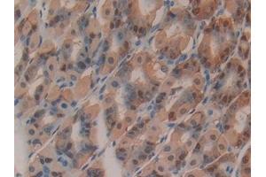 Detection of GSTo1 in Mouse Stomach Tissue using Polyclonal Antibody to Glutathione S Transferase Omega 1 (GSTo1) (GSTO1 抗体  (AA 24-233))