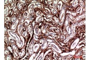 Immunohistochemistry (IHC) analysis of paraffin-embedded Human Kidney, antibody was diluted at 1:100. (M-CSF/CSF1 抗体  (Internal Region))