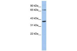 WB Suggested Anti-ZNF274 Antibody Titration:  0. (ZNF274 抗体  (Middle Region))