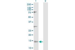 Western Blot analysis of NDUFV3 expression in transfected 293T cell line by NDUFV3 MaxPab polyclonal antibody. (NDUFV3 抗体  (AA 1-108))