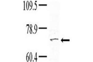 Image no. 1 for anti-Tyrosine Kinase, Non-Receptor, 1 (TNK1) (Middle Region) antibody (ABIN359998) (TNK1 抗体  (Middle Region))