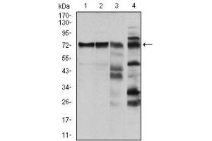 Western Blotting (WB) image for anti-V-Raf-1 Murine Leukemia Viral Oncogene Homolog 1 (RAF1) antibody (ABIN1844891) (RAF1 抗体)