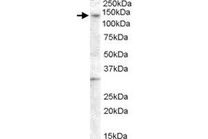 GPR125 polyclonal antibody  (0. (GPR125 抗体)