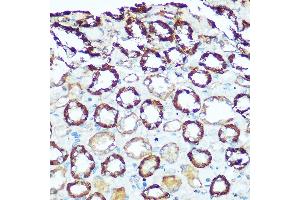 Immunohistochemistry (IHC) image for anti-ATP Synthase, H+ Transporting, Mitochondrial Fo Complex, Subunit D (ATP5H) (AA 1-161) antibody (ABIN6137333)
