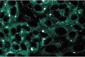 Immunofluorescence staining on human endothelial cells. (MAP2K5 抗体  (AA 13-188))