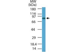 Western blot analysis of PRDM5 in HL-60 cell lysate using PRDM5 polyclonal antibody  at 1 ug/mL . (PRDM5 抗体  (AA 100-200))