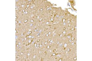 Immunohistochemistry (IHC) image for anti-Melanoma Antigen Family D, 1 (MAGED1) (AA 635-834) antibody (ABIN3021415)
