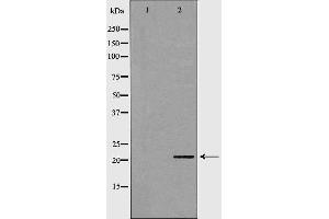 Western blot analysis of stomach  lysate using CSRP1 antibody. (CSRP1 抗体  (Internal Region))
