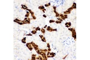 IHC-P: Calbindin antibody testing of mouse kidney tissue