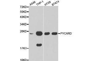 Western blot analysis of extracts of various cell lines, using PYCARD antibody (ABIN5970516). (PYCARD 抗体)