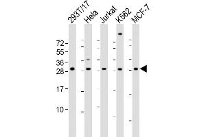 All lanes : Anti-RPL13 Antibody (Center) at 1:2000 dilution Lane 1: 293T/17 whole cell lysate Lane 2: Hela whole cell lysate Lane 3: Jurkat whole cell lysate Lane 4: K562 whole cell lysate Lane 5: MCF-7 whole cell lysate Lysates/proteins at 20 μg per lane. (RPL13 抗体  (AA 49-82))