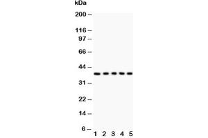 Western blot testing of Fas antibody and Lane 1:  HeLa;  2: Jurkat;  3: A549;  4: SMMC-7721;  5: K562 lysate (FAS 抗体  (AA 26-173))