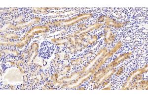 Detection of PCK1 in Mouse Kidney Tissue using Polyclonal Antibody to Phosphoenolpyruvate Carboxykinase 1, Soluble (PCK1) (PCK1 抗体  (AA 312-563))